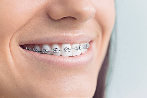 Best Wisdom Tooth Removal  in Gower, MO
